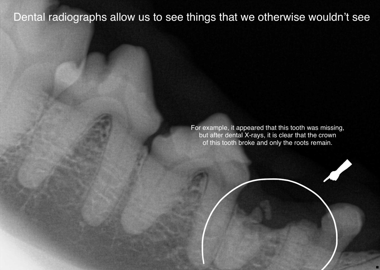 Dental Radiograph of Missing Crown